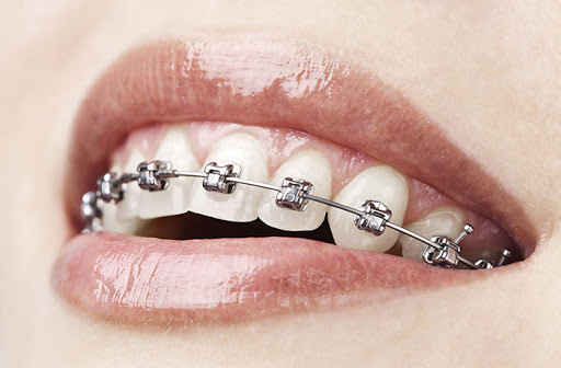 Love Your Smile Orthodontics