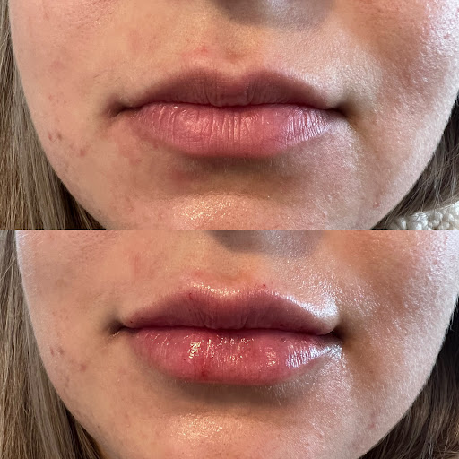 Revived Medical Aesthetics