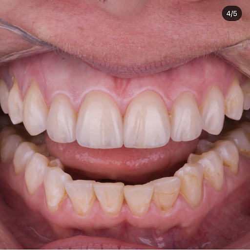 Ingenic Dental Studio - Thumbnail