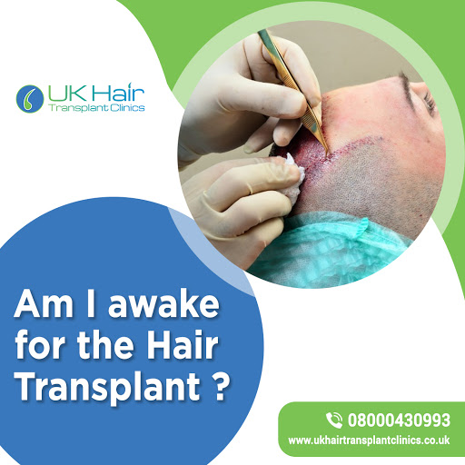 UK Hair Transplant Clinics Belfast - Thumbnail
