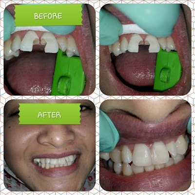 Photos of Bandung Dental Center Jatinangor