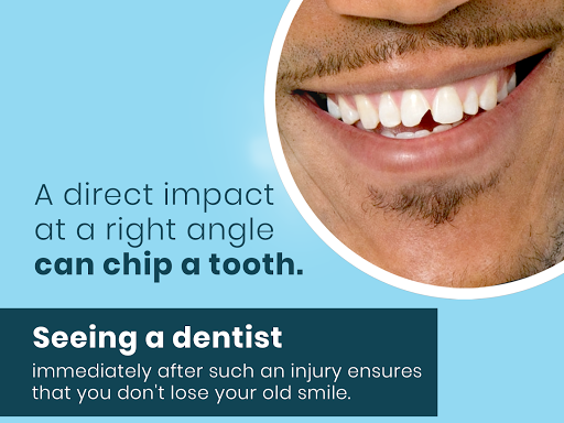 #smile #dental #doctor #dentist #teeth #tooth #dentalcare #dentalclinic #teethwhitening #denatlst… post image