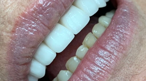 دكتور حازم مخيمر - صورة 5