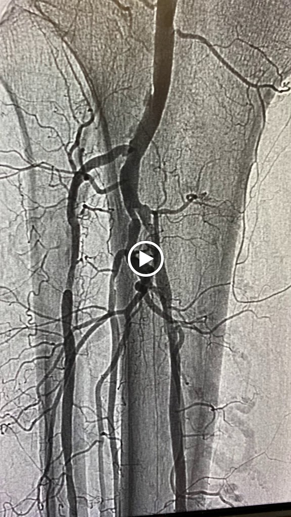 Pradeep Srivastava Md