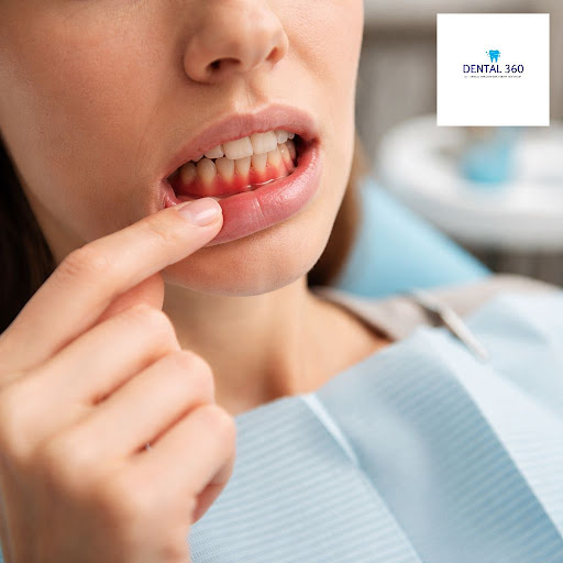 Bleeding gums, bad breath, or loose teeth are not normal. At Dr Sharwari's Dental 360 in Pune, ou… post image