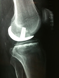 Photo n°9 de Clinique de l'Arthrose - Centre des Os et des Articulations de Paris à Paris (Clinique chirurgicale)