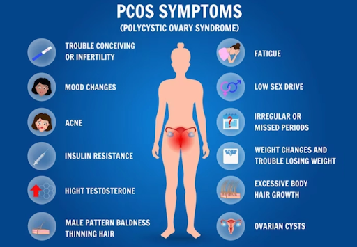 Polycystic Ovarian Disease (PCOD), also known as Polycystic Ovary Syndrome (PCOS) is a very commo… post image