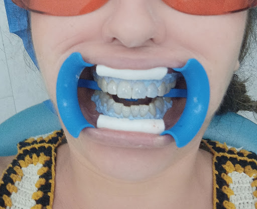 Clínica Dental Lucident - Thumbnail