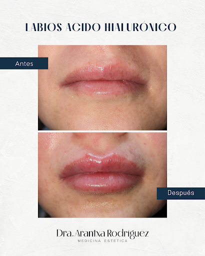 Dra.Arantxa Rodriguez Ortiz - Thumbnail