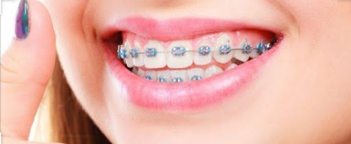 Cuidado Dental Especializado - Thumbnail