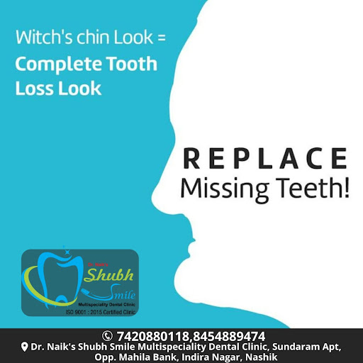 Replace missing teeth with our High Quality Implants wich have Life time Warranty only @Shubh Smi…