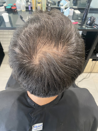 The Hair Revolution Hair Spa - Thumbnail