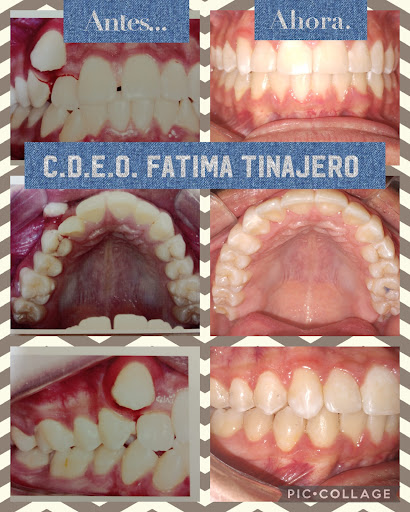 Consultorio Dental C.D. Fatima Gpe. Tinajero Perez - Thumbnail