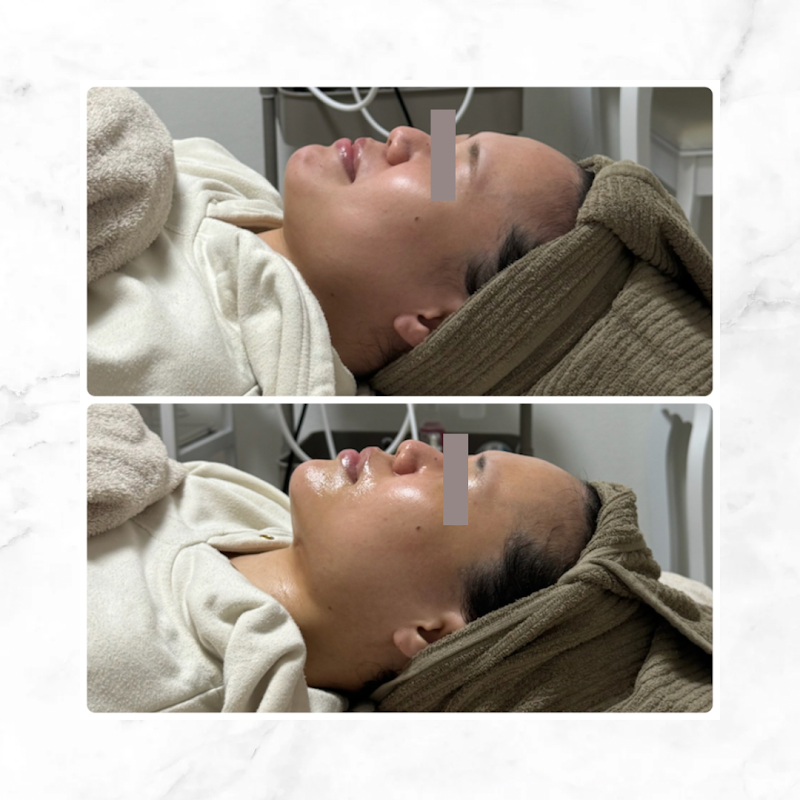 小顔コルギSALON サラン