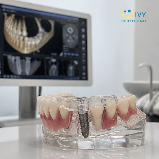Dental implants can transform your smile, but many patients worry about pain and healing time. At… post image