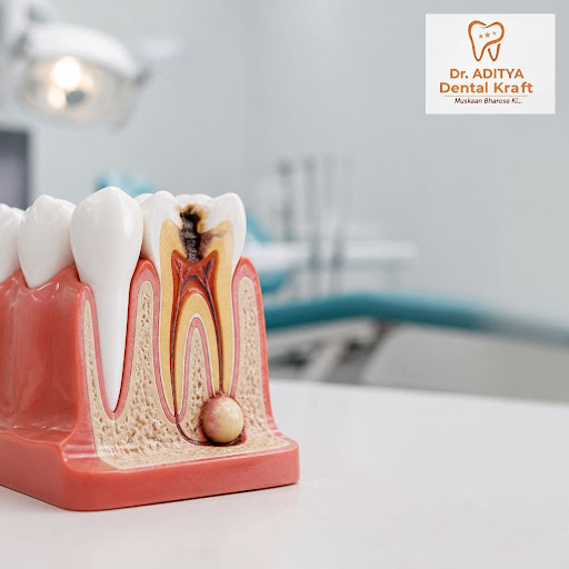A painful swelling in your gums or jaw is never normal. Dental abscesses are infections that can… post image