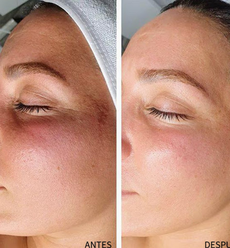 Clínica De tratamientos faciales B&R - Thumbnail