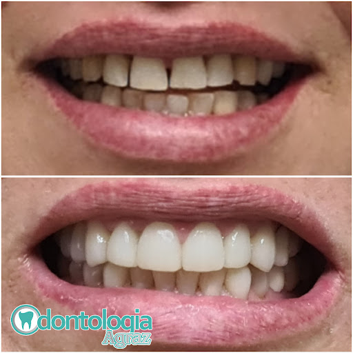 ODONTOLOGIA AGRAZ - Thumbnail