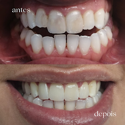 Photo n°8 de Dr Silva, Cristiana à Vauréal (Prosthodontiste)
