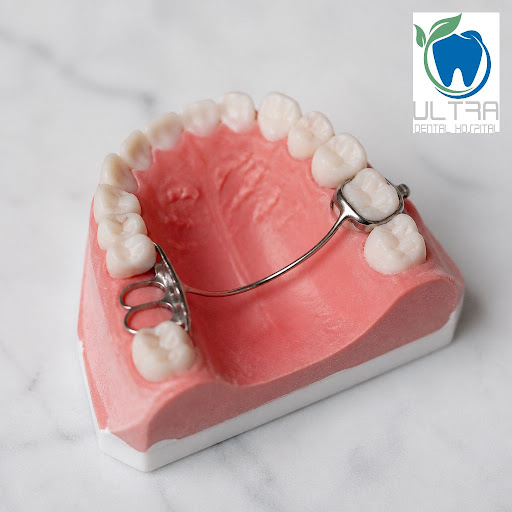 Early tooth loss in children is more common than many parents realize, and it can affect how perm… post image