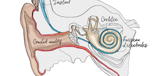 Photo n°18 de Perrier Audition à Faverges-Seythenex (Magasin d'appareils auditifs)