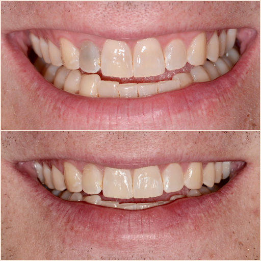 Sweet Tooth Dentistry Valencia/Dr. Grace Hwang - Thumbnail