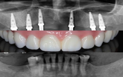 ORTO ORAL CLINICA DENTO FACIAL. Dr. Hernandez Cerda Jose luis - Thumbnail