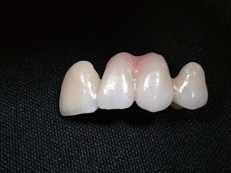 Creative Image Dental Laboratory, CEREC DS CORE Support Dental Laboratory photo 2