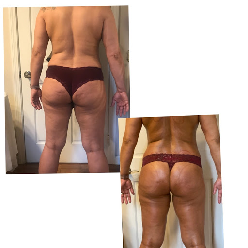 Karin Slimming Massage only for women Gallery - United States