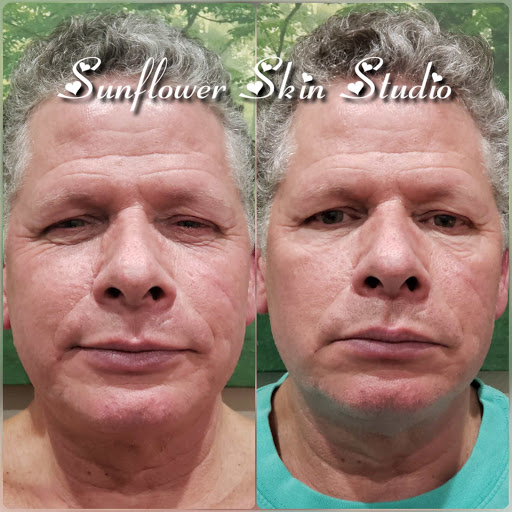 Sunflower Skin Studio