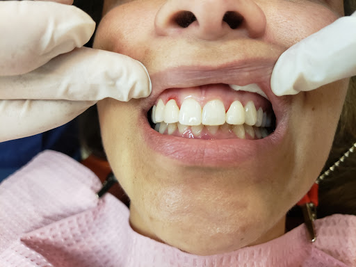 San Diego emergency dentist Reza Kasiri dds