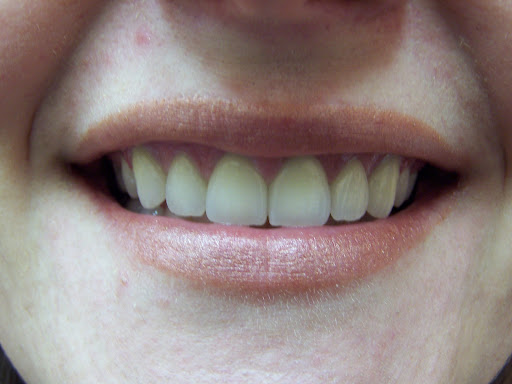 Dentistry On Taunton Ajax