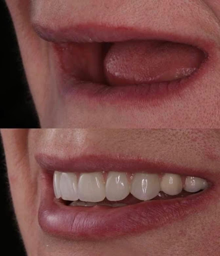 Consultorio dental DentalXpert - Thumbnail