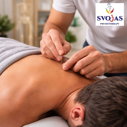 Curious about dry needling and how it can help your pain? At Svojas Physiotherapy by Dr. Shivani… post image