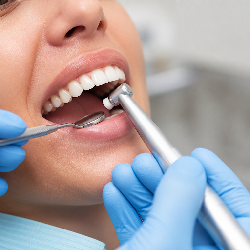 Struggling with yellow teeth, bad breath or bleeding gums? Professional dental scaling and polish… post image