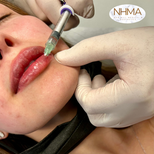 Nob Hill Aesthetics | Medical Spa