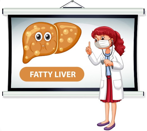 Fatty liver occurs when excess fat accumulates in the liver. It may cause few or no noticeable sy… post image