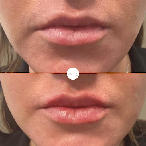 Wilmington Plastic Surgery & Med Spa