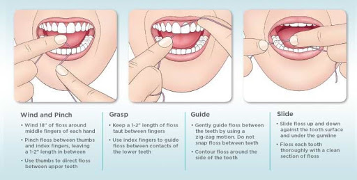 Benefits of Floss post image