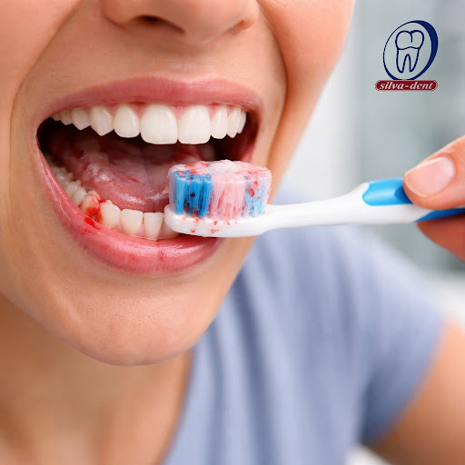 Noticing blood on your toothbrush or while rinsing? Bleeding gums are not normal and can be an ea… post image