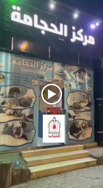 مركز الحجامه عفيف حجامه - صورة 2