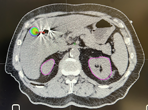 Photo n°10 de Institut de Cancérologie de Seine et Marne - Radiothérapie Jossigny à Jossigny (Programme de bien-être)