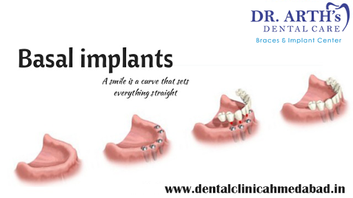 https://www.google.com/maps/place/Dr.+Arth's+Dental+Care+-+Dentist+In+Prahladnagar/@23.0128444,72…