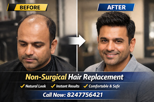 Looking for the best non-surgical hair replacement in Hyderabad? Farhan Hair Fixing provides natu… post image