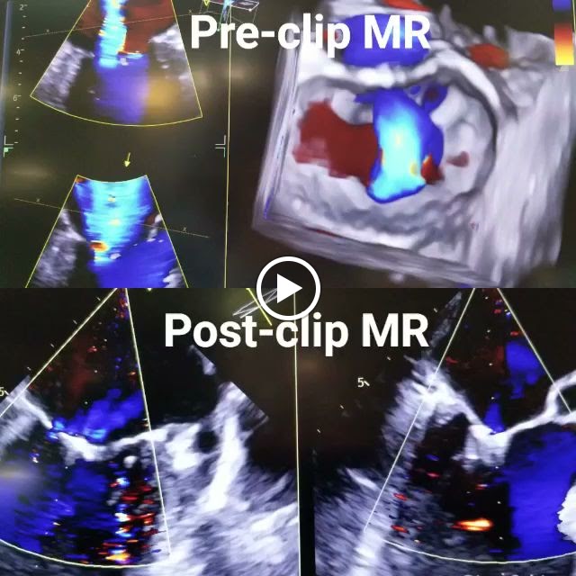 Saint Gregory Heart And Vascular Center