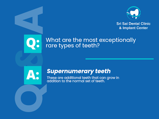 Nature's Dental Surprises: Unveiling the Enigma: Exploring the World of Rare Teeth post image
