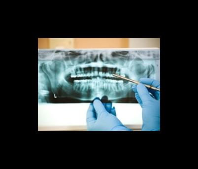 Studio Dentistico Dr. Alberto Zecchetto - Thumbnail