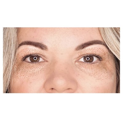 DermaLux Repigmentation Clinic