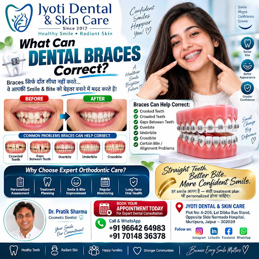 क्या Dental Braces सिर्फ टेढ़े दाँत सीधे करने के लिए होते हैं? 🤔 post image
