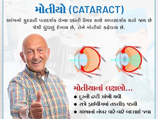 મોતિયાના લક્ષણો ... post image